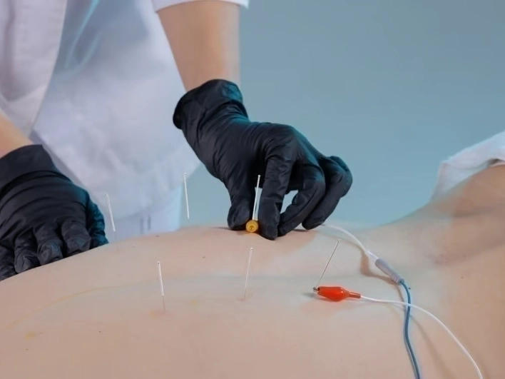 Premier Injury Specialists service area covering Stonecrest, GA and surrounding neighborhoods