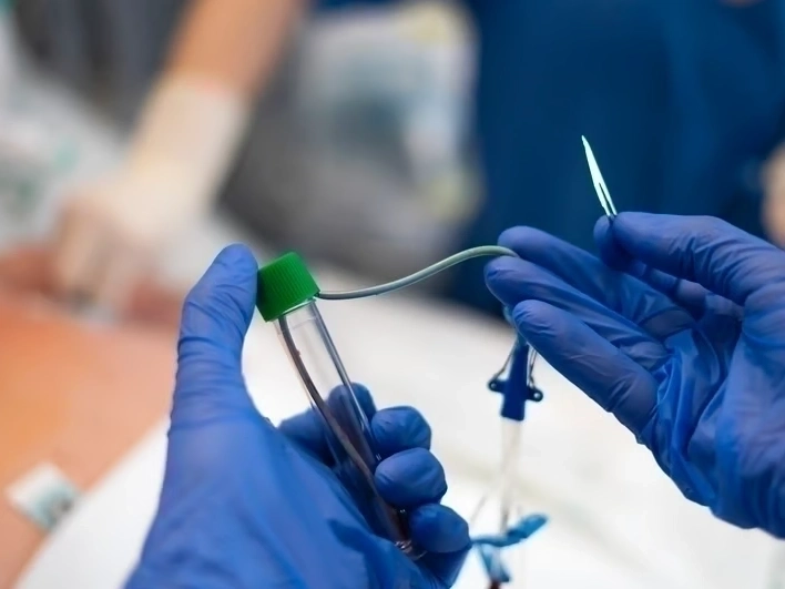 Professional Radiofrequency Ablation Therapy services by Premier Injury Specialists in Stonecrest, GA — licensed Injury Specialists provider