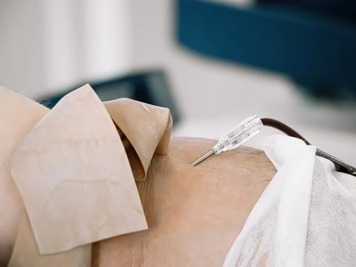 Premier Injury Specialists service area covering the area, GA and surrounding neighborhoods